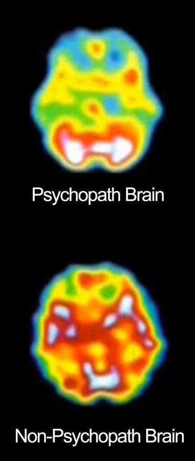 Psychopath-Brains.jpg